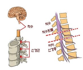 마미총 신경 사진